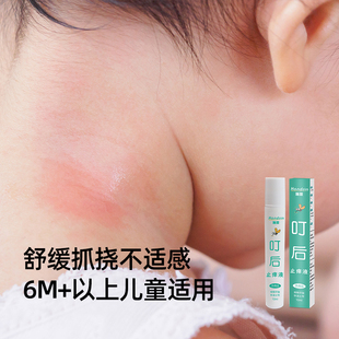 Handsin瀚思止痒液走珠冰露婴儿蚊虫叮咬儿童宝宝舒缓止痒膏