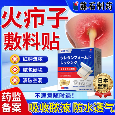 火疖子疖肿敷料贴【破溃流脓护理