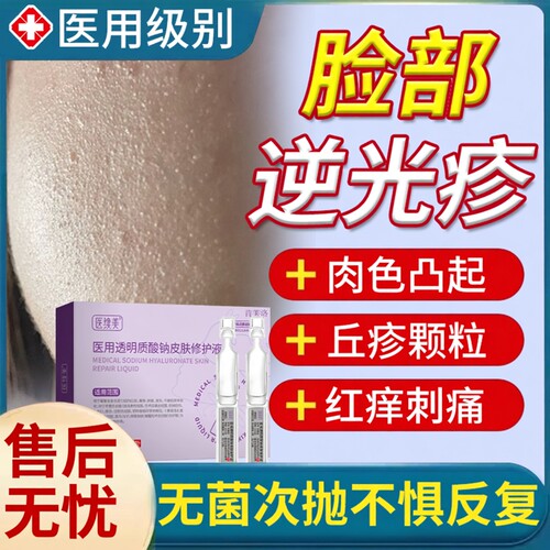 速发】脸上逆光疹长肉色丘疹专用