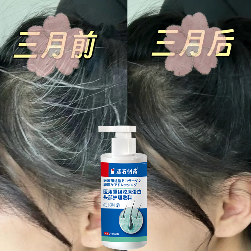 医用重组胶原蛋白头部护理敷料白发精华液转黑洗脱发发水变黑发YS