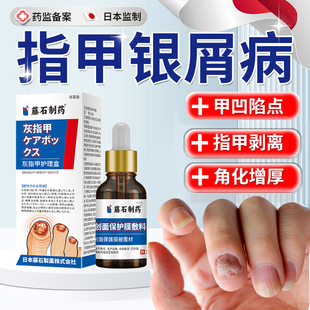 银屑病甲指甲真菌感染剥离发黄增厚凹凸不平修复液药房同款YM