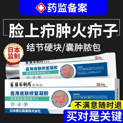 【日本公司监制】脸上疖肿火疖子