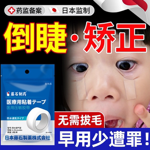 倒睫贴婴儿儿童下眼睑睫毛倒睫毛矫正专用神器成人眼皮下垂提拉YS
