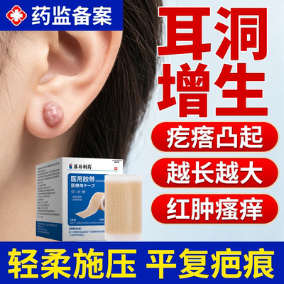 【速发】耳洞增生凸起疙瘩疤痕贴