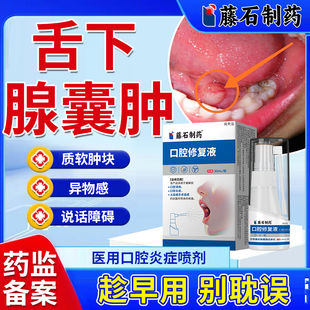 舌下腺囊肿口腔结石粘唾液腺舌根青筋长疙瘩腺体堵塞专用喷剂YM