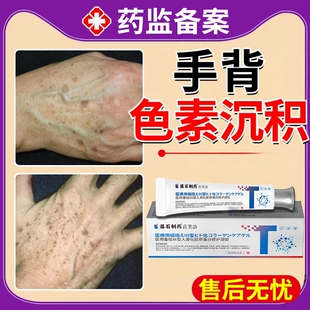 手背手上专用去老年斑强力去除的老人中药除老年黑班非膏药贴膏YS