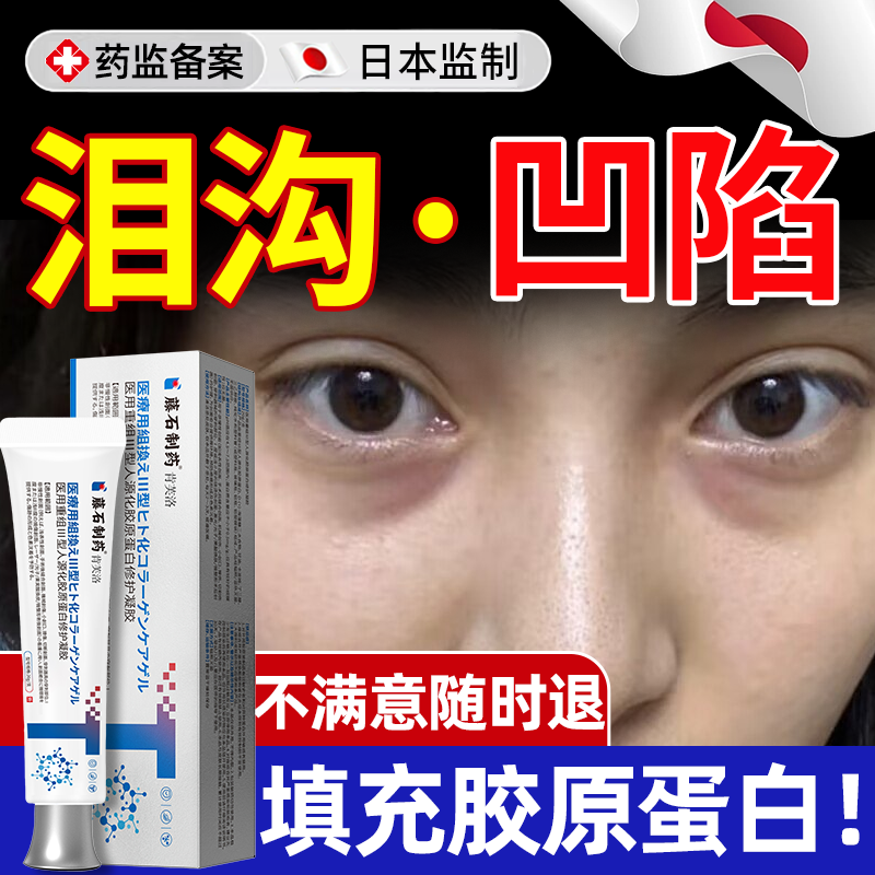 泪沟填充非神器眼窝凹陷修复去除胶原蛋白去改善眼部法令纹消除YS,保健用品,面部健康,淘宝优惠券,粉丝福利购,淘宝优惠卷