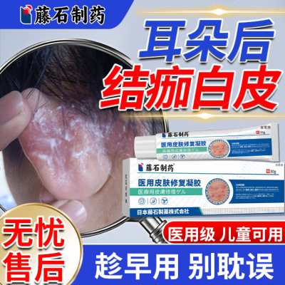 耳朵后面结痂有白皮耳朵痒止痒去干燥根起皮过敏红痒外耳道湿疹YM