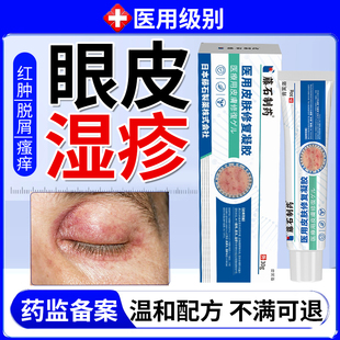 眼皮湿疹专用除湿止痒膏眼皮癣红肿痒眼睛周围过敏发痒儿童医用YM