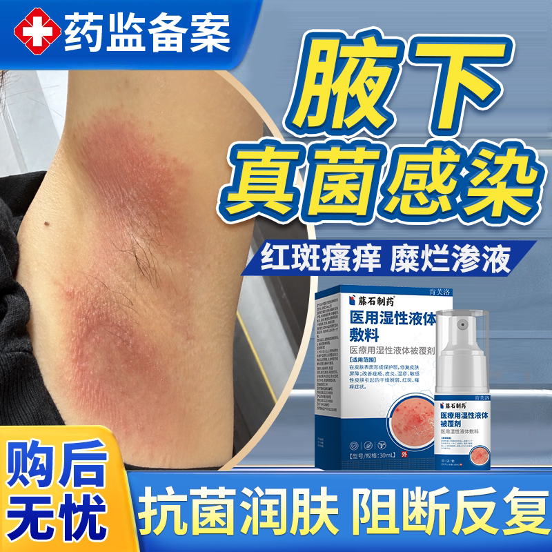 腋下真菌感染淹红防腋窝胳肢窝湿疹可搭皮肤细菌癣药膏外用喷雾YS