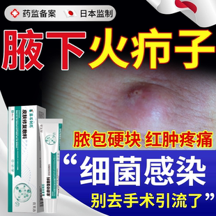 腋下腋窝火疖子拔毒拔脓膏毛囊炎脓包硬块疖肿可搭药膏敷料贴用YS