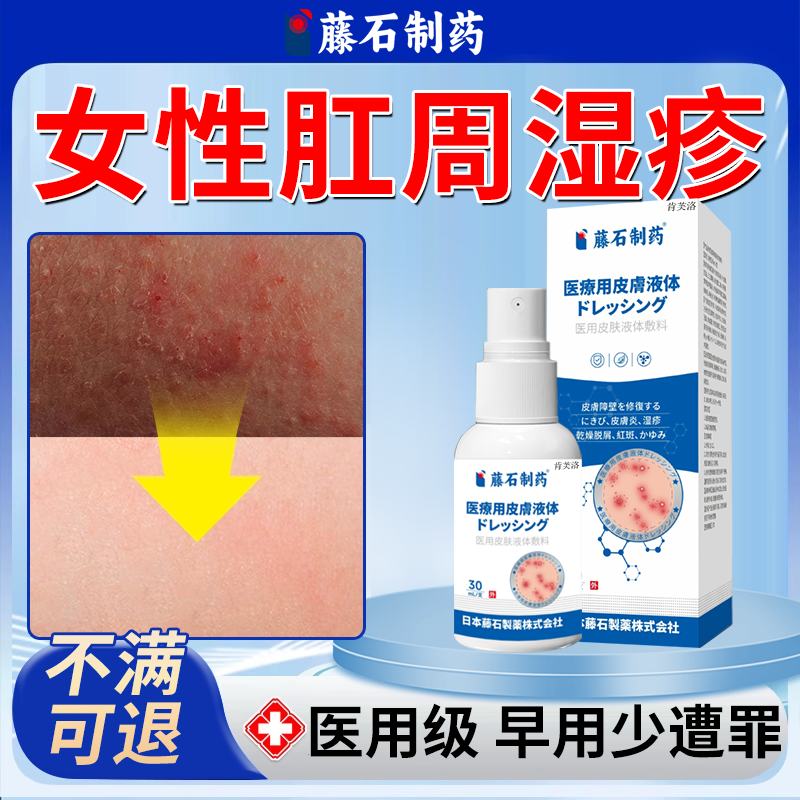 【现货速发】女性肛周湿疹瘙痒