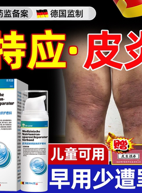 特应性皮炎止痒去保湿霜根软膏儿童身体乳特异药房过敏湿疹专用YS