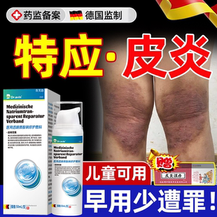 特应性皮炎止痒去保湿霜根软膏儿童身体乳特异药房过敏湿疹专用YS