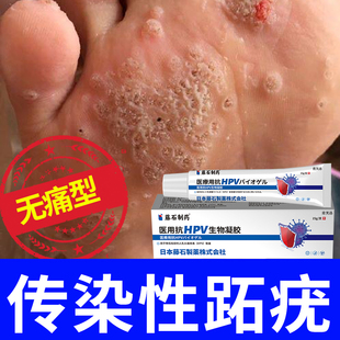 传染性跖疣专用膏去除根足部脚底肉刺碘酊病毒疣拔脚上长硬疙瘩YM