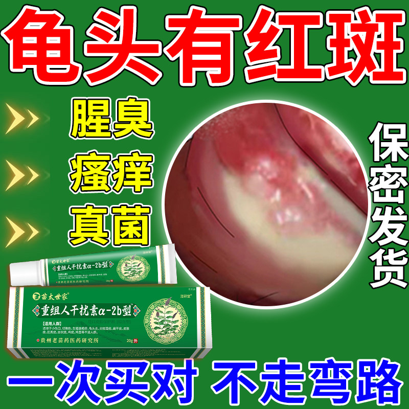 龟头上红斑真菌感染溃烂红肿糜烂开裂发炎豆腐渣白垢包皮炎发痒ro