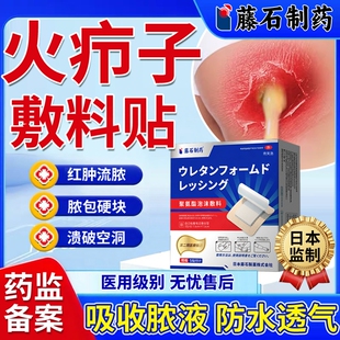 疖肿贴火疖子敷料贴疖肿拔毒膏吸脓贴屁股硬块脓包药监备案医用YM