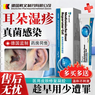 耳朵湿疹外耳道真菌感染去耳朵发炎专用痒脱皮流脓根药房同款膏YY