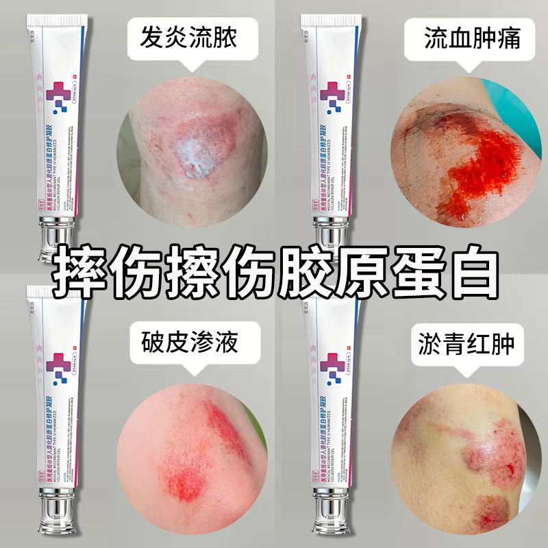 摔伤搭擦伤破皮药伤口快速愈合药膏用促进长肉快的儿童消炎结痂YS