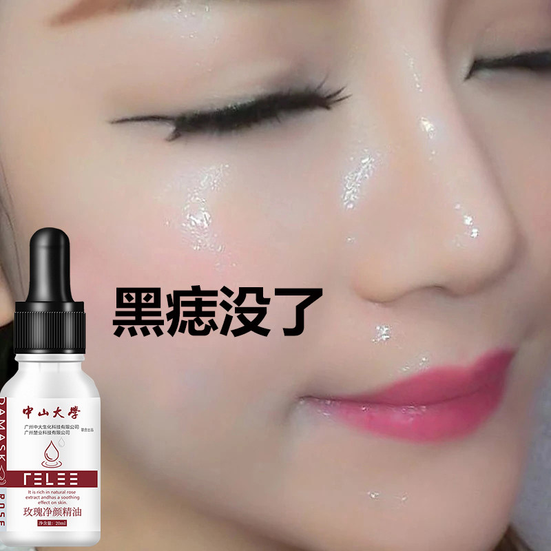 【李佳琦推荐】158三瓶一疗程 去脸上一切斑点黑点 净颜玫瑰精油
