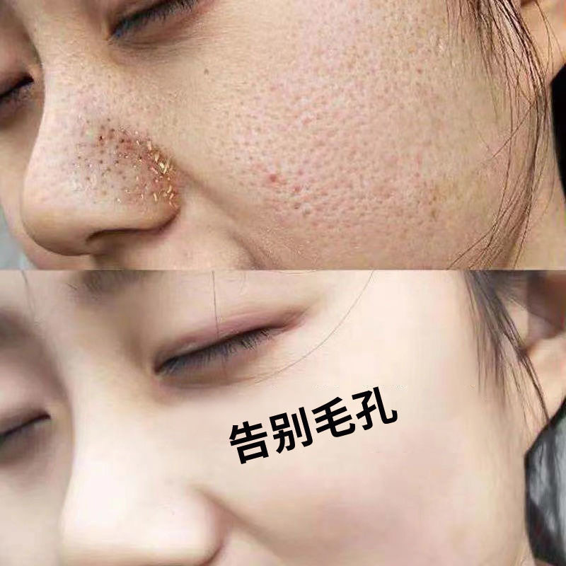 【屈臣氏推荐】 左旋乳酸收缩毛孔精华液 男女通用 拍2发3送同款