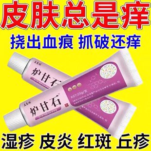 正品炉甘石乳膏草本萃取舒缓全身涂抹外用痒痒膏甘石正品全身通用