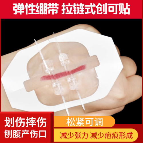 灵扣医用皮肤减张器伤口愈