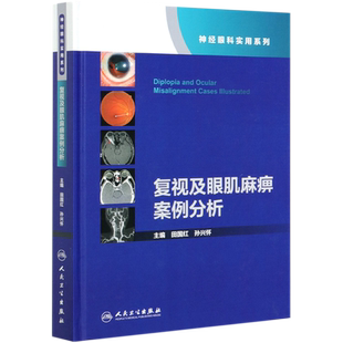复视及眼肌麻痹案例分析(精)/神经眼科实用系列