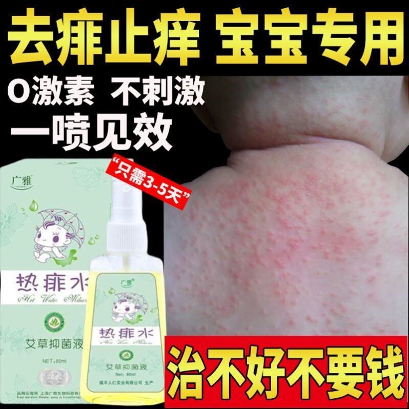 热痱子止痒水成人儿童宝宝身上去痱喷雾祛痱膏防婴儿专用粉除长菲