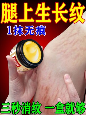 生长纹肥胖纹霜大腿学生腰腹上肥胖纹大腿纹路专用药膏