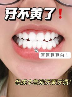 牙齿美白 黄牙去黄牙齿神器牙白牙黄美白洗牙齿污垢除牙石洗 速效