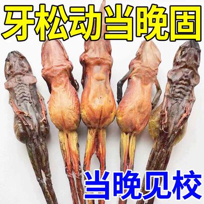 牙齿松动牙龈肿痛萎缩牙痛牙晃动固齿专用牙膏治疗牙松动的药固定