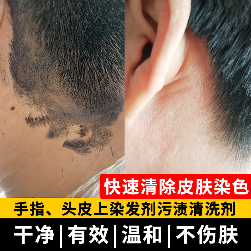 男女士染发后的皮肤无残留清洗剂