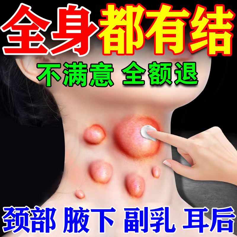 淋巴结消散膏肿大散结贴膏消除腋下脖子颈部肿痛结节消炎疏通膏贴