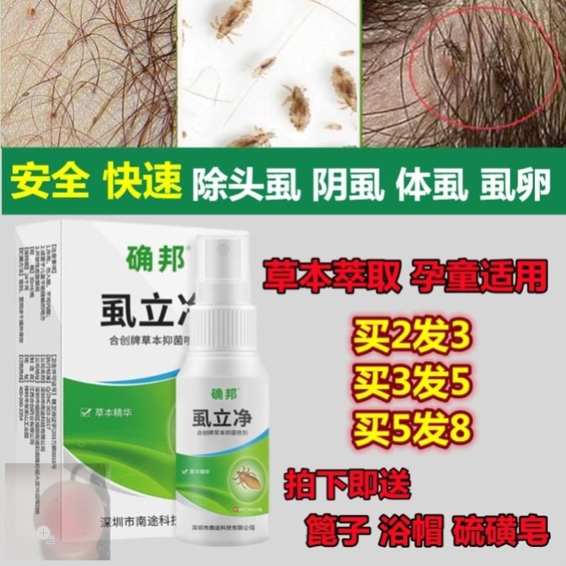 虱子药小女孩头发虱立净虱卵儿童头虱子狮子药水头上长的药