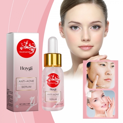 HOYGI烟酰胺抗痘精华液温和祛痘