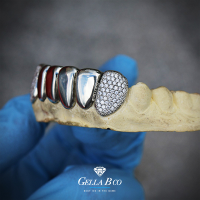 GELLA 素面单颗镶钻grillz 微镶钻 牙套定制 欣赏