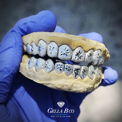 GELLA 冰花 菱格手工雕刻grillz嘻哈牙套定制 欣赏