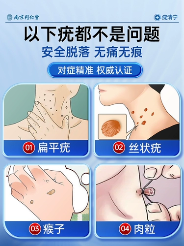 Плоские бородавки -бородавки для удаления маленького мяса на шее, гангстеры без модей, оттенки духа, удалите артефакты, чтобы удалить мазь бородавки