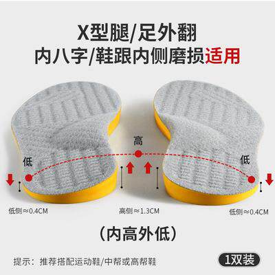 鞋垫男女美腿型内外八字脚扁平足O形脚足弓适用X型腿足外翻定制