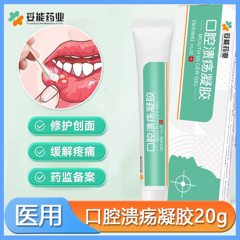 妥能药业口腔溃疡凝胶一点灵医用儿童上火舌头复发性起水泡喷雾剂