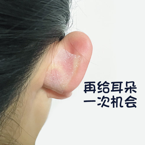 微娜精灵耳贴贴面耳神器无限回购