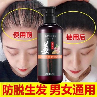 产后防脱发洗发水生发增发密发掉头发生姜脱发严重女士男专用神器