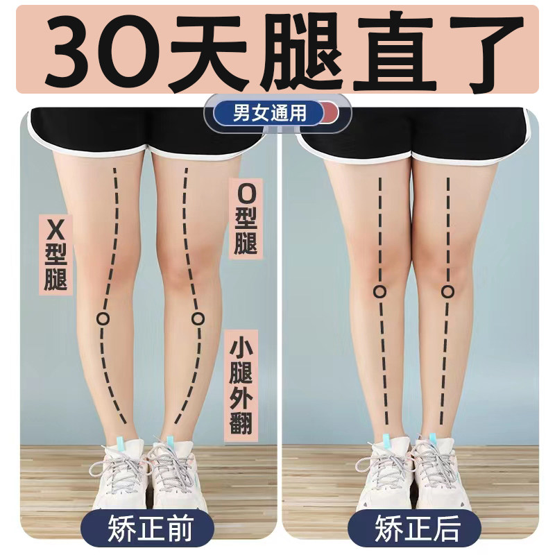 【小红书推举】o型腿/x型腿 矫正神器 告别不良站姿 给自己的礼物