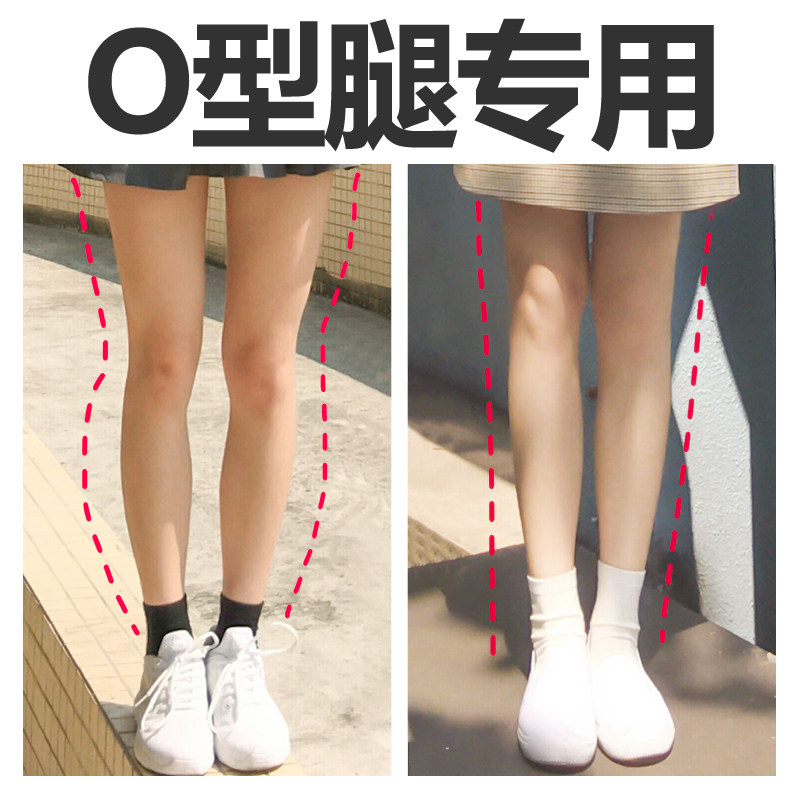 o型腿鞋垫矫正腿型神器直腿纠正小腿外翻改善内外八字xo型x腿型女