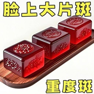 【斑斑无影踪】红花皂斑淡晒老年黑色素黄褐斑洗脸淡斑温和洗面