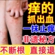 止痒特效药皮肤瘙痒湿疹外用去根苗家湿毒膏进口正品 专用抑菌乳膏