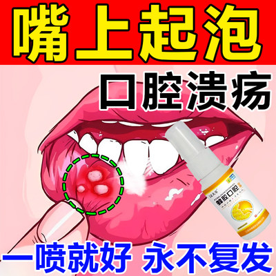 口腔上火嘴巴舌头烂口腔内壁起泡破止疼嘴溃疡养护粘膜口腔喷剂药