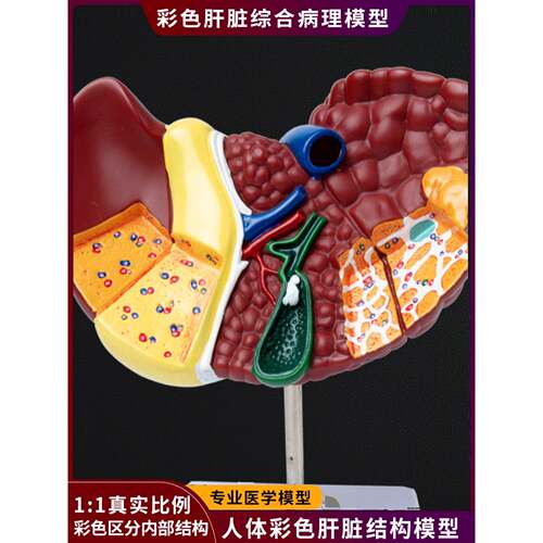 医学模拟人体肝脏解剖模型肝脏胆囊胆囊胆囊结构消化系统器官示范
