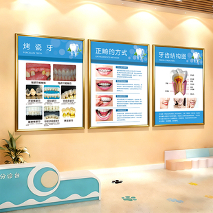 口腔诊所挂画牙科诊室宣传海报挂图医院墙面装饰画牙齿护理形象墙